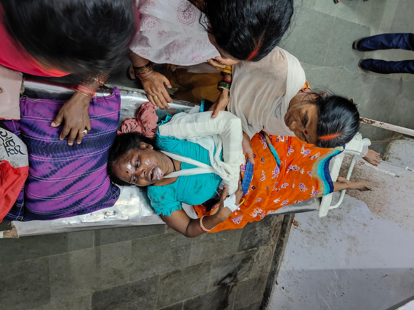 बंदरो के खौफ से छत से गिरी महिला